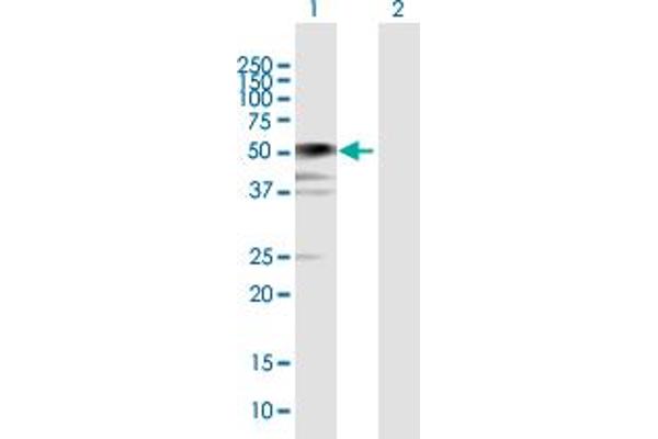 BCCIP Antikörper  (AA 1-322)