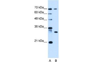 WB Suggested Anti-ATP6AP1L Antibody Titration:  0. (ATP6AP1L Antikörper  (C-Term))