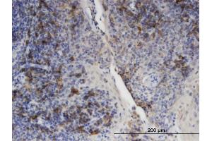 Immunoperoxidase of monoclonal antibody to PLIN3 on formalin-fixed paraffin-embedded human tonsil. (PLIN3 Antikörper  (AA 1-434))