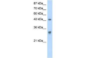 WB Suggested Anti-DDX19B Antibody Titration:  2. (DDX19B Antikörper  (C-Term))