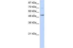 Western Blotting (WB) image for anti-IKAROS Family Zinc Finger 3 (Aiolos) (IKZF3) antibody (ABIN2461838) (IKZF3 Antikörper)