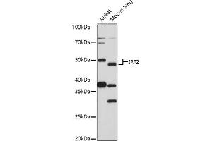Western blot analysis of extracts of various cell lines, using (ABIN3023366, ABIN3023367, ABIN3023368 and ABIN6219659) at 1:1000 dilution. (IRF2 Antikörper  (AA 120-349))