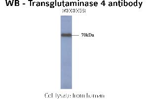 Image no. 1 for anti-Transglutaminase 4 (Prostate) (TGM4) antibody (ABIN347024) (TGM4 Antikörper)