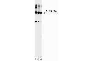 Western blot analysis of mGluR1alpha. (mGluR1 alpha Antikörper)