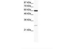 Image no. 1 for anti-ZFP91 Zinc Finger Protein (ZFP91) (AA 96-145) antibody (ABIN6736013) (ZFP91 Antikörper  (AA 96-145))
