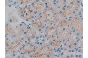 Immunohistochemistry (IHC) image for anti-Heparanase (HPSE) (AA 40-188) antibody (ABIN7437449)