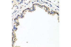Immunohistochemistry of paraffin-embedded rat lung using CXCR4 antibody (ABIN6292854) at dilution of 1:100 (40x lens). (CXCR4 Antikörper)