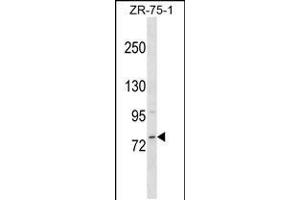 Western blot analysis in ZR-75-1 cell line lysates (35ug/lane). (MICALCL Antikörper  (N-Term))