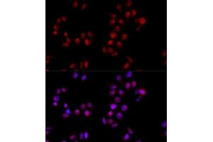 Immunofluorescence analysis of HeLa cells using HMGB1 antibody. (HMGB1 Antikörper  (AA 100-200))