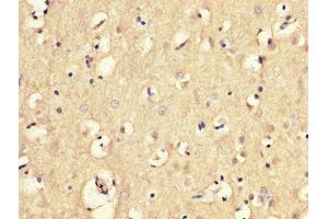 IHC image of ABIN7159059 diluted at 1:300 and staining in paraffin-embedded human brain tissue performed on a Leica BondTM system. (MGP Antikörper  (AA 20-96))