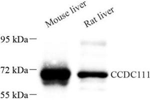 Western blot analysis of CCDC111 (ABIN7073534) at dilution of 1: 500 (CCDC111 Antikörper)