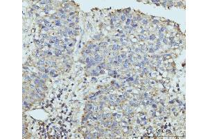 IHC analysis of HUPF2/RENT2/UPF2 using anti-HUPF2/RENT2/UPF2 antibody (ABIN7600567). (RENT2/UPF2 Antikörper  (AA 200-651))