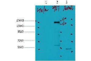 Western Blotting (WB) image for anti-Receptor tyrosine-protein kinase erbB-2 (ErbB2/Her2) antibody (ABIN3181149) (ErbB2/Her2 Antikörper)