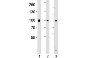 Western blot testing of Suz12 antibody at 1:1000 dilution. (SUZ12 Antikörper  (AA 496-530))
