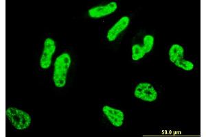 Immunofluorescence (IF) image for anti-RCSD Domain Containing 1 (RCSD1) (AA 181-289) antibody (ABIN530093)