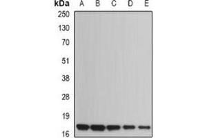 Western blot analysis of UBE2B expression in Jurkat (A), NIH3T3 (B), mouse heart (C), rat heart (D), rat brain (E) whole cell lysates. (UBE2B Antikörper)