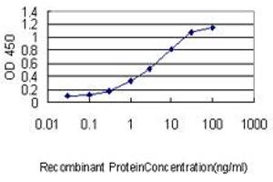 Detection limit for recombinant GST tagged SRF is approximately 0. (SRF Antikörper  (AA 406-508))
