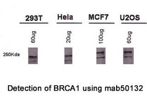 Image no. 1 for anti-Breast Cancer 1 (BRCA1) (AA 1314-1600), (AA 1314-1864) antibody (ABIN363286) (BRCA1 Antikörper  (AA 1314-1600, AA 1314-1864))