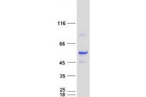 Validation with Western Blot