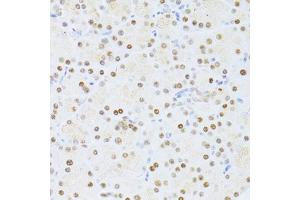 Immunohistochemistry of paraffin-embedded rat pancreas using ETV1 antibody (ABIN6291698) at dilution of 1:100 (40x lens). (ETV1 Antikörper)