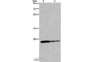 Western blot analysis of HT-29 cell and human fetal brain tissue, using GSTP1 Polyclonal Antibody at dilution of 1:350 (GSTP1 Antikörper)