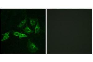 Immunofluorescence (IF) image for anti-Gonadotropin-Releasing Hormone Receptor (GNRHR) (Internal Region) antibody (ABIN1852968) (GNRHR Antikörper  (Internal Region))