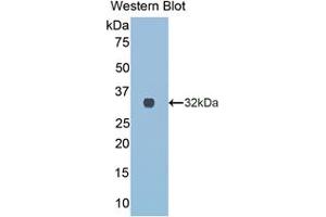 Western blot analysis of the recombinant protein. (COL3A1 Antikörper  (AA 1171-1435))