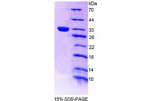 SDS-PAGE analysis of Human TEC Protein. (Tec Protein Tyrosine Kinase (TEC) Protein)