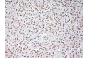 Immunohistochemical staining of paraffin-embedded colon tissue using anti-VEGFmouse monoclonal antibody. (VEGF Antikörper  (AA 27-233))