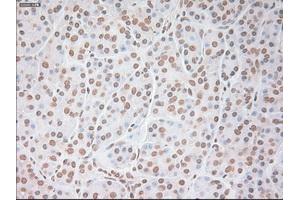 Immunohistochemical staining of paraffin-embedded colon tissue using anti-VEGFmouse monoclonal antibody.