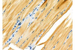 ABIN6262730 and ABIN6266734 at 1/100 staining Rat pancreatic tissue by IHC-P. (Adenylate Kinase 1 Antikörper  (Internal Region))