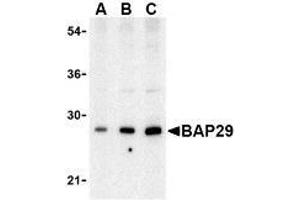 Western blot analysis of Bap29 in human heart tissue lysate with AP30120PU-N Bap29 antibody at (A) 0. (BCAP29 Antikörper  (Intermediate Domain))