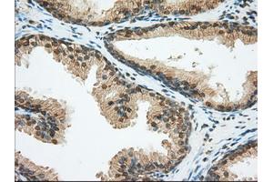 Immunohistochemical staining of paraffin-embedded liver tissue using anti-BSG mouse monoclonal antibody. (CD147 Antikörper)