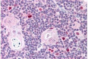 Human Thymus (formalin-fixed, paraffin-embedded) stained with AIRE antibody ABIN293603 at 2. (AIRE Antikörper  (AA 102-115))