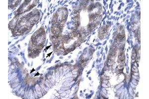EAP30 antibody was used for immunohistochemistry at a concentration of 4-8 ug/ml to stain EpitheliaI Cells of Fundic Gland (arrows) and Surface Mucous Cells (Indicated with Arrow Heads) in Human Stomach. (SNF8 Antikörper  (N-Term))