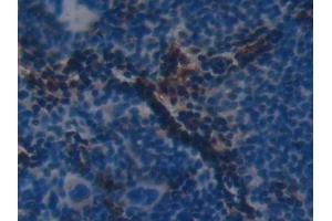Detection of CFH in Mouse Spleen Tissue using Polyclonal Antibody to Complement Factor H (CFH)