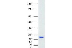 LMO4 Protein (Myc-DYKDDDDK Tag)