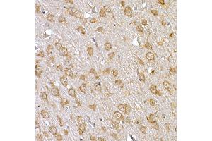 Immunohistochemistry of paraffin-embedded rat brain using IRS1 Rabbit pAb (ABIN3020773, ABIN3020774, ABIN3020775, ABIN1513104 and ABIN6213716) at dilution of 1:150 (40x lens). (IRS1 Antikörper)