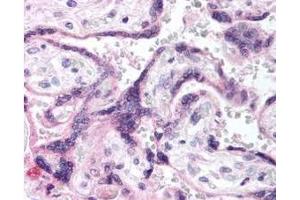 Immunohistochemistry of Rabbit anti-EGFR pY1197 antibody. (EGFR Antikörper  (AA 1175-1200))