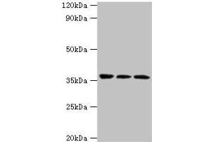 Western blot All lanes: SLAMF7 antibody at 3 μg/mL Lane 1: Jurkat whole cell lysate Lane 2: K562 whole cell lysate Lane 3: Mouse spleen tissue Secondary Goat polyclonal to rabbit IgG at 1/10000 dilution Predicted band size: 38, 26, 18, 33, 23, 22 kDa Observed band size: 38 kDa (SLAMF7 Antikörper  (AA 23-226))