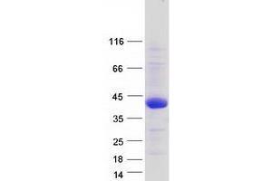 Validation with Western Blot (TMEM169 Protein (Transcript Variant 4) (Myc-DYKDDDDK Tag))