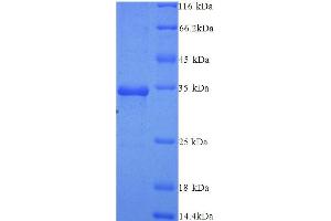SDS-PAGE (SDS) image for Argonaute 2 (AGO2) (AA 517-818) protein (His tag) (ABIN5714512)