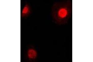 Immunofluorescent analysis of TEAD2 staining in HepG2 cells.