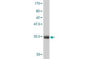 Western Blot detection against Immunogen (36. (CTNNB1 Antikörper  (AA 682-781))