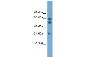 WB Suggested Anti-WDR16 Antibody Titration: 0. (WDR16 Antikörper  (Middle Region))