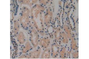 IHC-P analysis of Human Kidney Tissue, with DAB staining. (PLAT Antikörper  (AA 311-562))