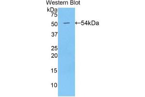 Western blot analysis of the recombinant protein. (BMP1 Antikörper  (AA 610-843))