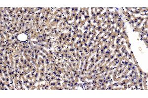 Detection of TXNRD1 in Mouse Liver Tissue using Polyclonal Antibody to Thioredoxin Reductase 1 (TXNRD1) (TXNRD1 Antikörper  (AA 374-577))