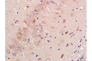 Formalin-fixed and paraffin embedded rat brain labeled with Anti-Contactin 3 Polyclonal Antibody, Unconjugated (ABIN761441) at 1:200 followed by conjugation to the secondary antibody and DAB staining (CNTN3 Antikörper  (AA 301-400))