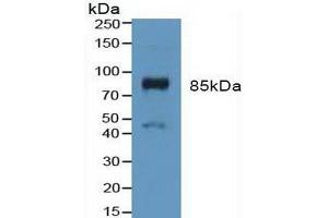 Detection of FGFR3 in Mouse Placenta Tissue using Polyclonal Antibody to Fibroblast Growth Factor Receptor 3 (FGFR3) (FGFR3 Antikörper  (AA 166-375))